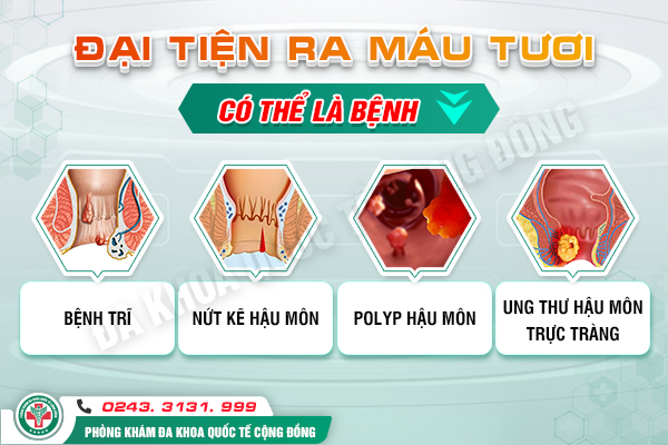 Đi cầu ra máu cảnh báo bệnh lý nguy hiểm nào?