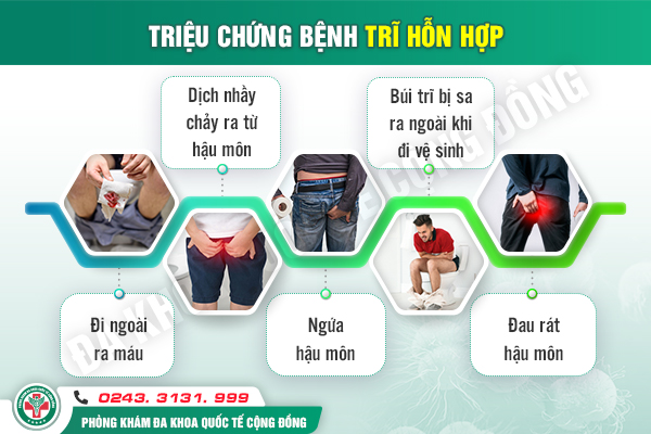 Dấu hiệu nhận biết trĩ hỗn hợp độ 3 – Nhận biết sao cho đúng?