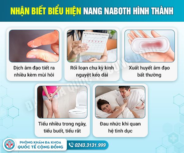 Hỏi đáp nang naboth – Những điều quan trọng bạn cần biết
