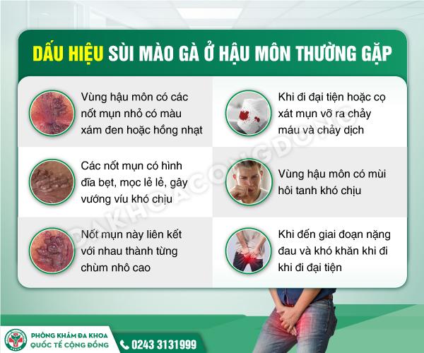 Sùi hậu môn