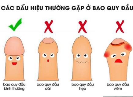 Bệnh bao quy đầu