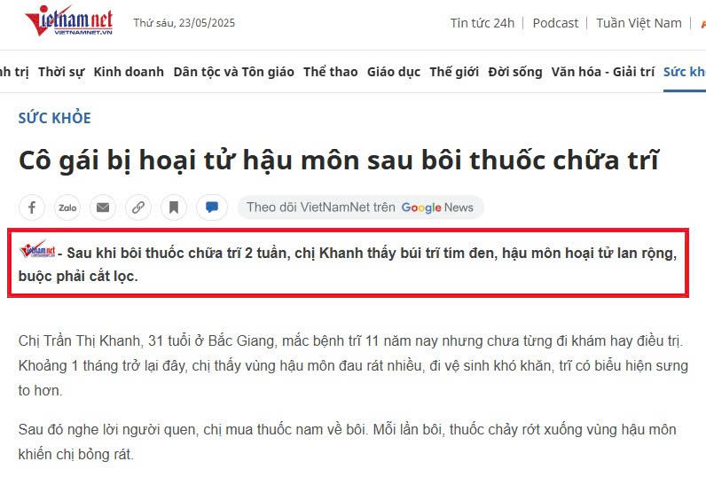 Cách chữa trĩ nội hiệu quả: Lựa chọn tối ưu cho người bệnh!
