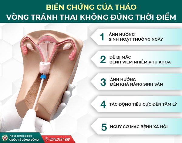 Tại sao phải tháo vòng tránh thai? Tháo vòng tránh thai có ảnh hưởng gì không?