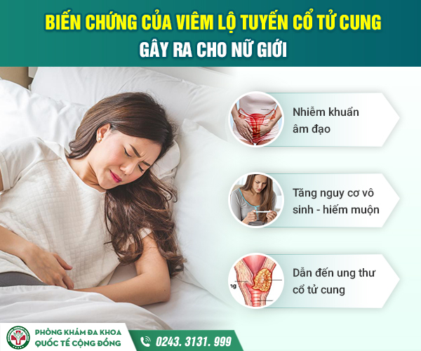 Tác hại viêm lộ tuyến cổ tử cung: Không thể xem thường!
