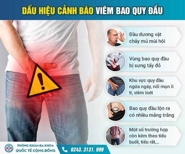 Bác sĩ chuyên khoa tư vấn về bệnh viêm bao quy đầu và cách điều trị hiệu quả