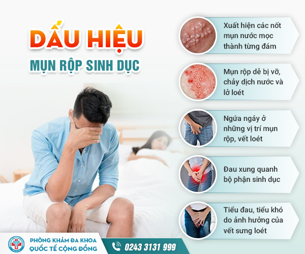 Mụn rộp sinh dục