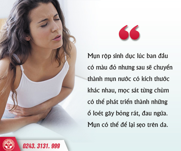 Herpes âm đạo ở nữ giới và những điều cần biết