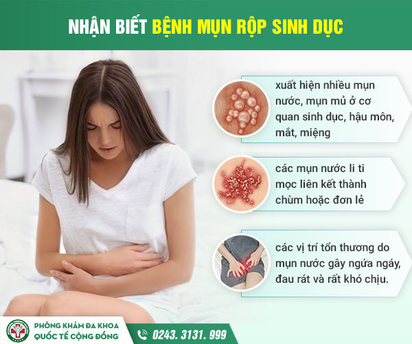Mụn rộp sinh dục, nguyên nhân, triệu chứng và cách chữa