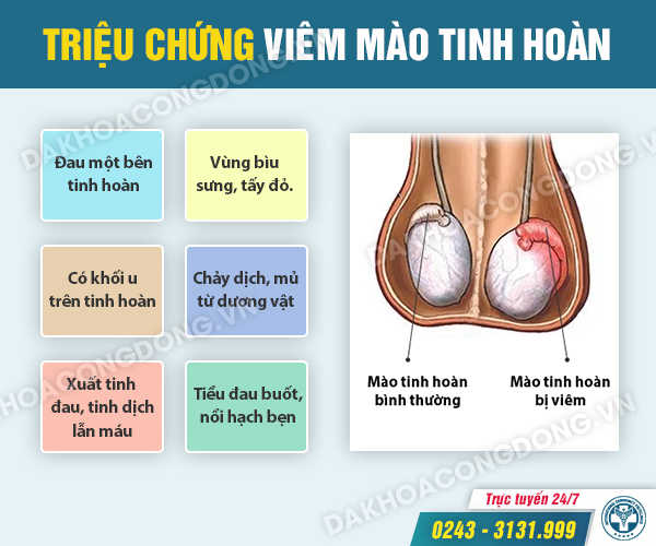 Viêm tinh hoàn và mào tinh hoàn là gì?