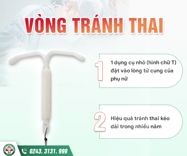Nếu muốn đặt vòng tránh thai an toàn cần lưu ý những điều sau…