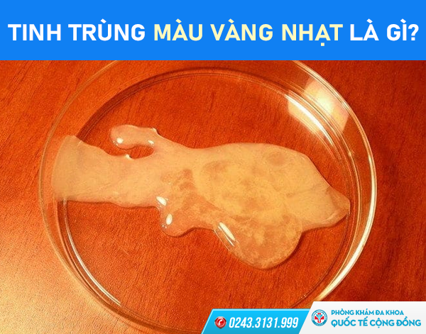 Tinh trùng có màu vàng nhạt cảnh báo nhiều bệnh lý ở nam giới