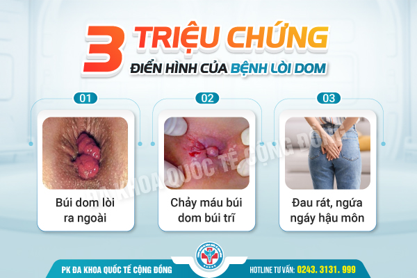 Đừng bỏ qua những dấu hiệu bệnh trĩ ngoại thường gặp này