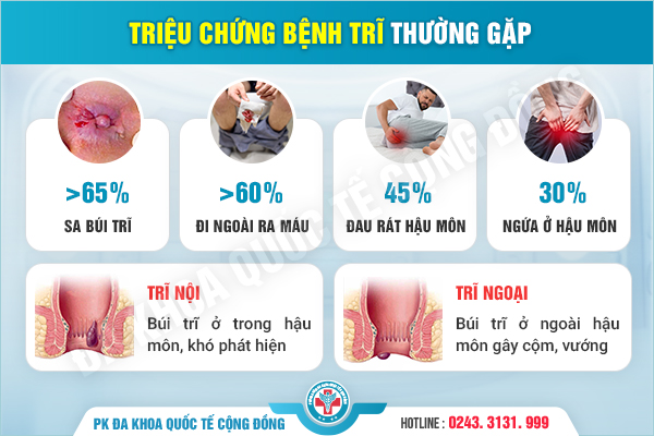 Nổi cục thịt ở hậu môn là bệnh gì, có nguy hiểm không?