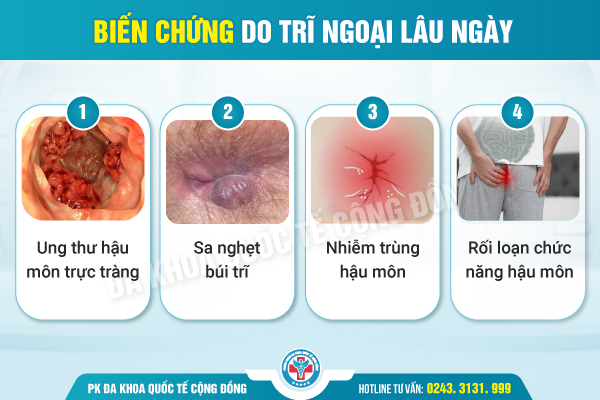 Cắt trĩ ngoại ở đâu được nhiều bệnh nhân tin tưởng lựa chọn?
